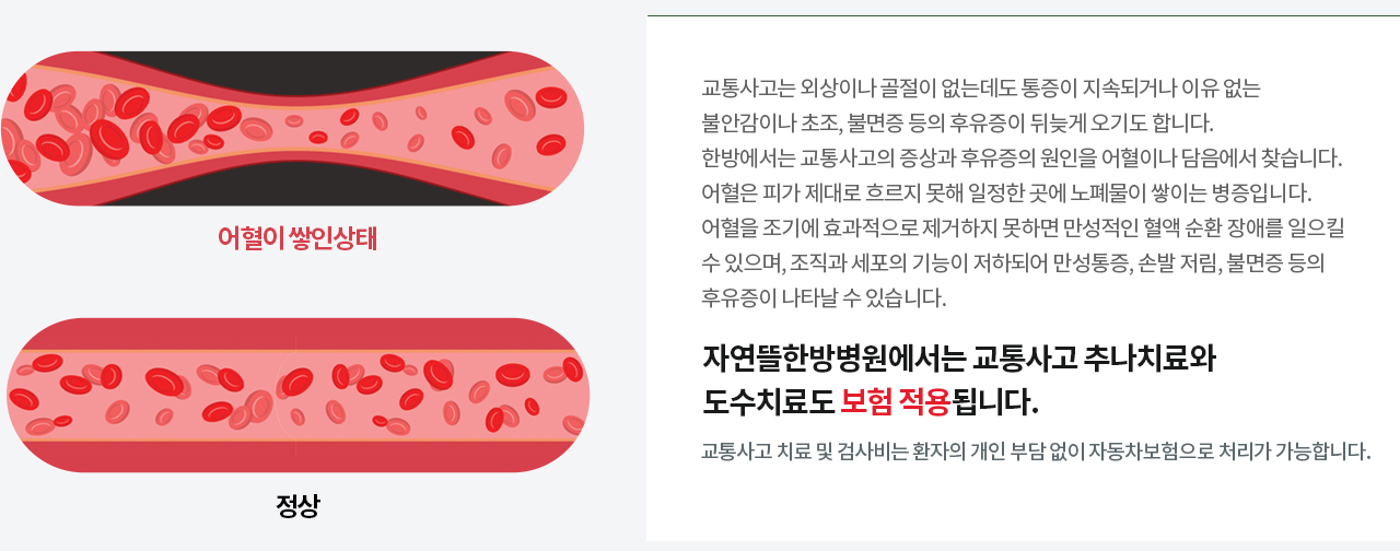 자연뜰한방병원 입원집중치료클리닉